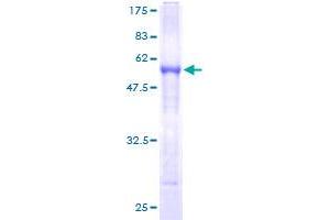 SERPINB8 Protein (AA 1-242) (GST tag)
