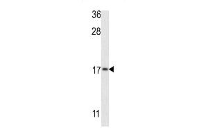 Western blot analysis of G8b (M1LC3B) Antibody (T93/Y99) 1802e in MCF-7 cell line lysates (35 μg/lane). (APG8b (AA 74-106) anticorps)