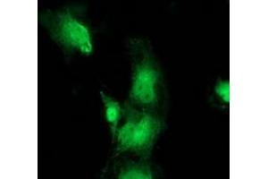 Anti-BEST3 mouse monoclonal antibody (ABIN2453917) immunofluorescent staining of COS7 cells transiently transfected by pCMV6-ENTRY BEST3 (RC218436). (Bestrophin 3 anticorps)