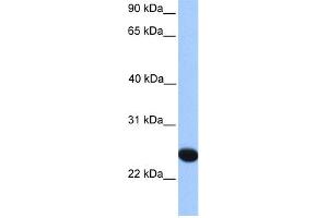 WB Suggested Anti-CSGlcA-T Antibody Titration:  0. (CHPF2 anticorps  (N-Term))