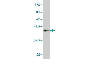 Western Blot detection against Immunogen (37.