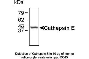 Image no. 1 for anti-Cathepsin E (CTSE) (C-Term) antibody (ABIN363354) (Cathepsin E anticorps  (C-Term))