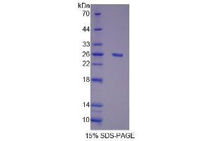 Image no. 1 for Polymerase (DNA Directed), gamma (POLG) (AA 1041-1239) protein (His tag) (ABIN6237466)