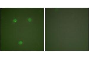Immunofluorescence analysis of COS7 cells, using GADD153 Antibody.