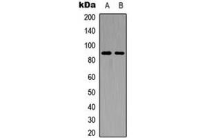 Western blot analysis of FGFR4 expression in HEK293T (A), PC12 (B) whole cell lysates. (FGFR4 anticorps  (C-Term))