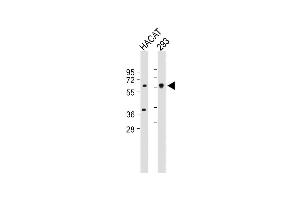 All lanes : Anti-SGPL1 Antibody (N-term) at 1:1000 dilution Lane 1: HACAT whole cell lysate Lane 2: 293 whole cell lysate Lysates/proteins at 20 μg per lane.