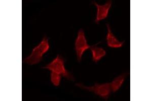 ABIN6266497 staining COLO205 by IF/ICC. (APAF1 anticorps  (C-Term))