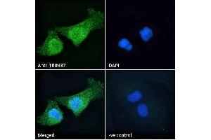 ABIN184830 Immunofluorescence analysis of paraformaldehyde fixed HeLa cells, permeabilized with 0. (TRIM37 anticorps  (C-Term))