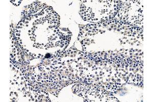 ABIN7096380 and ABIN7100444 at 1/100 staining mouse testis tissue by IHC-P. (PMPCA anticorps)