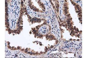 Image no. 10 for anti-Destrin (Actin Depolymerizing Factor) (DSTN) antibody (ABIN1497910) (Destrin anticorps)