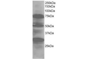 Image no. 1 for anti-LIM Domain 7 (LMO7) (Internal Region) antibody (ABIN374384) (LMO7 anticorps  (Internal Region))