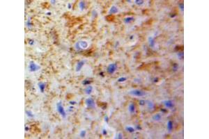 Used in DAB staining on fromalin fixed paraffin-embedded Brain tissue (Neuroglobin anticorps  (AA 1-151))