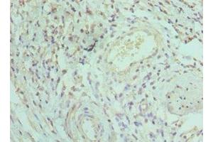 Immunohistochemistry of paraffin-embedded human epityphlon tissue using ABIN7156750 at dilution of 1:100