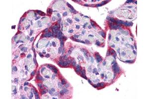 Immunohistochemistry (IHC) image for anti-ATG5 Autophagy Related 5 (ATG5) (C-Term) antibody (ABIN2785620) (ATG5 anticorps  (C-Term))