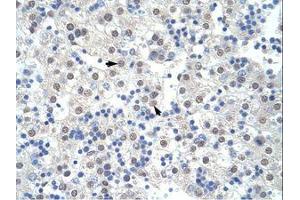 Image no. 1 for anti-Pre-mRNA Branch Site Protein p14 (SF3B14) (AA 90-139) antibody (ABIN203256)