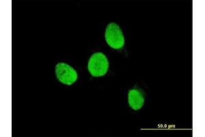 Immunofluorescence of monoclonal antibody to TESK2 on HeLa cell. (TESK2 anticorps  (AA 405-542))