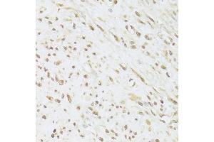 Immunohistochemistry of paraffin-embedded human leiomyoma of uterus using SNRPA Antibody. (SNRPA1 anticorps  (AA 1-282))