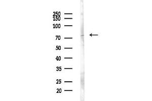 Western blot analysis of lysates from EC304 cells(heat-shock,45 min treatment), using NDC80 Antibody at 1/1000 dilution.