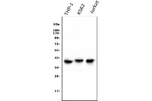 Western blot analysis of CCR2 using anti-CCR2 antibody (ABIN7598970).