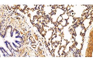 Detection of CAV1 in Rat Lung Tissue using Polyclonal Antibody to Caveolin 1 (CAV1)