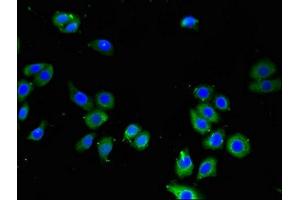 Immunofluorescent analysis of PC-3 cells using ABIN7158308 at dilution of 1:100 and Alexa Fluor 488-congugated AffiniPure Goat Anti-Rabbit IgG(H+L) (Leupaxin anticorps  (AA 1-300))