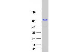 Validation with Western Blot