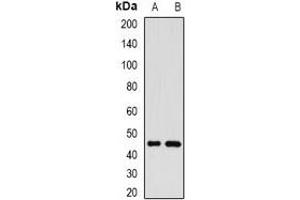 Western blot analysis of GP73 expression in SKOV3 (A), SHSY5Y (B) whole cell lysates. (GOLM1 anticorps)