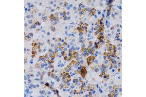 Immunohistochemistry of paraffin-embedded rat pancreas using CYP24 antibody (805) at dilution of 1:200 (40x lens). (CYP24A1 anticorps  (AA 36-448))