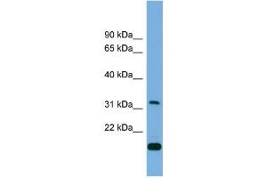 WB Suggested Anti-CTDSP2 Antibody Titration: 0. (CTDSP2 anticorps  (Middle Region))