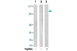 Western blot analysis of extracts from LoVo cells (Lane 1) and A-549 cells (Lane 2 and lane 3), using JAKMIP2 polyclonal antibody . (JAKMIP2 anticorps  (C-Term))