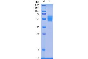 Human D Protein, mFc Tag on SDS-PAGE under reducing condition.