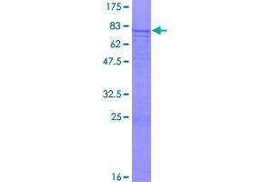 Image no. 1 for Centromere Protein I (CENPI) (AA 1-522) protein (GST tag) (ABIN1349114)