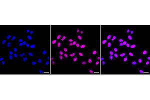 Immunocytochemical staining of HepG2 cells with PRPF4 antibody (ABIN7800057), 1:1,000).