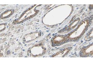 ABIN6277549 at 1/100 staining Human prostate tissue by IHC-P. (Cullin 5 anticorps  (Internal Region))