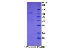 SDS-PAGE analysis of Human EGR3 Protein. (EGR3 Protéine)