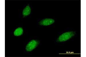 Immunofluorescence of purified MaxPab antibody to MMS19 on HeLa cell.