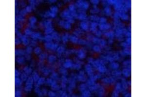 Immunofluorescence analysis of Rat spleen tissue using Phospho-IkB alpha (Ser32/S36) Polyclonal Antibody at dilution of 1:200