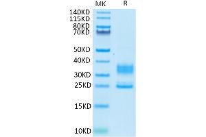 Human CD3E&CD3D on Tris-Bis PAGE under reduced condition.