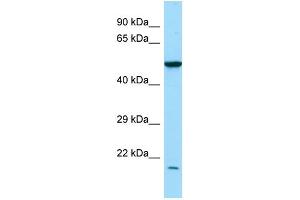 WB Suggested Anti-RAB7L1 Antibody Titration: 1. (RAB7L1 anticorps  (N-Term))
