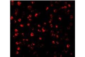 Immunofluorescence of ATF6 in MCF7 cells with this product atF6 antibody at 10 µg/ml. (ATF6 anticorps  (C-Term))