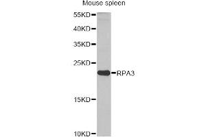 Western blot analysis of extracts of mouse spleen, using RPA3 antibody. (RPA3 anticorps)