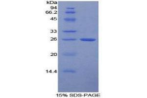 SDS-PAGE (SDS) image for Fc Receptor, IgG, High Affinity I (FCGR1) (AA 35-235) protein (His tag,T7 tag) (ABIN1879170)