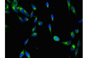 Immunofluorescent analysis of Hela cells using ABIN7174080 at dilution of 1:100 and Alexa Fluor 488-congugated AffiniPure Goat Anti-Rabbit IgG(H+L)