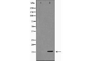 Western blot analysis on COLO205 cell lysate using Histone H3 Antibody，The lane on the left is treated with the antigen-specific peptide. (Histone 3 anticorps)