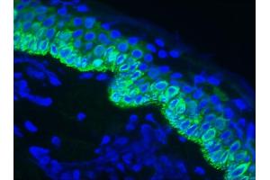 Image no. 2 for anti-Keratin 14 (KRT14) antibody (ABIN335329)