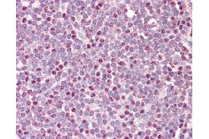 Anti-CDCA5 / Sororin antibody IHC staining of human tonsil. (CDCA5 anticorps  (AA 110-159))