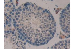 Detection of F13A1 in Mouse Testis Tissue using Polyclonal Antibody to Coagulation Factor XIII A1 Polypeptide (F13A1)