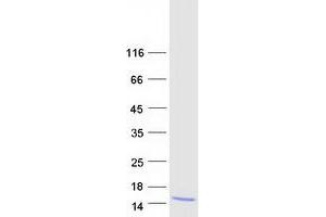 Validation with Western Blot