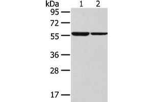 Gel: 8 % SDS-PAGE, Lysate: 40 μg, Lane 1-2: K562 and hepg2 cell, Primary antibody: ABIN7192521(SLC7A11 Antibody) at dilution 1/300 dilution, Secondary antibody: Goat anti rabbit IgG at 1/8000 dilution, Exposure time: 30 seconds (SLC7A11 anticorps)
