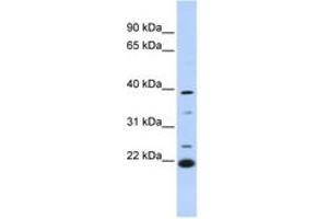 Image no. 1 for anti-Penta-EF-Hand Domain Containing 1 (PEF1) (AA 180-229) antibody (ABIN6744280) (PEF1 anticorps  (AA 180-229))